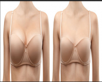 Image for Breast Reduction Surgery Cost in Delhi