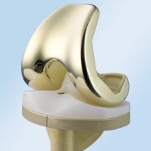 Knee replacement Surgery cost in Mumbai